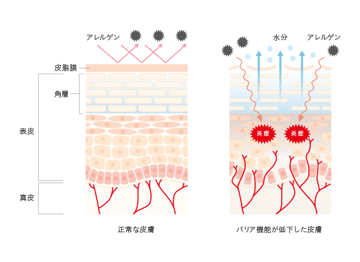 バリア機能